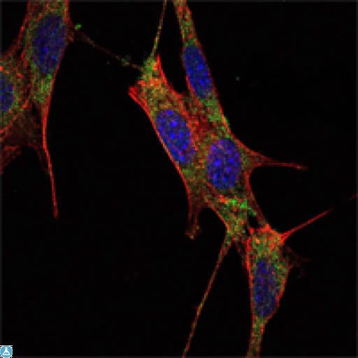 SMAD4 Antibody
