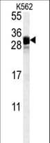 FGF7 / KGF Antibody (aa57-86)