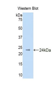 DHH / Desert Hedgehog Antibody (aa212-392)