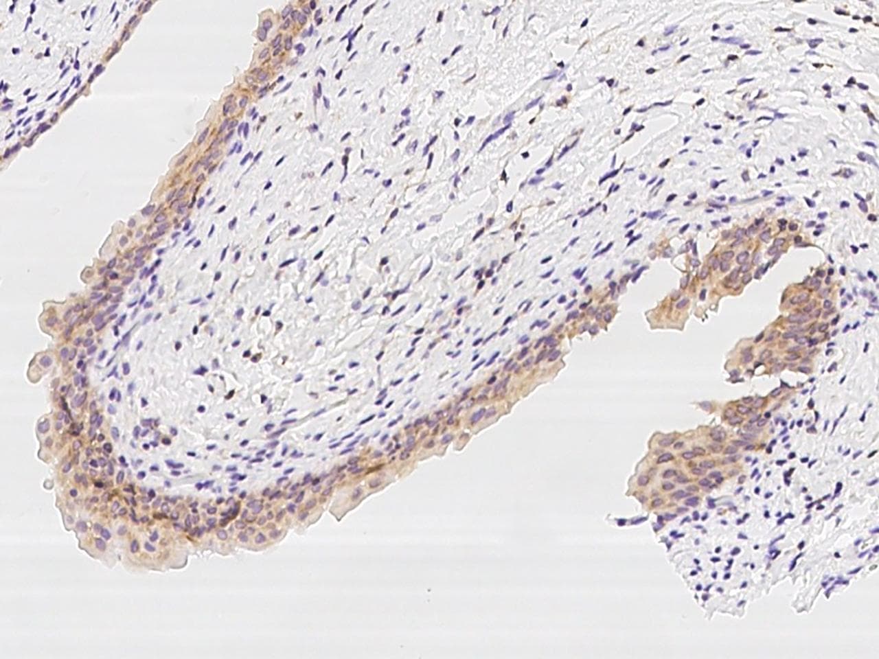 PFDN1 Antibody