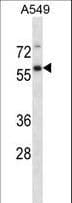 Polyclonal Rabbit anti-Human USP30 Antibody (aa156-185, WB)