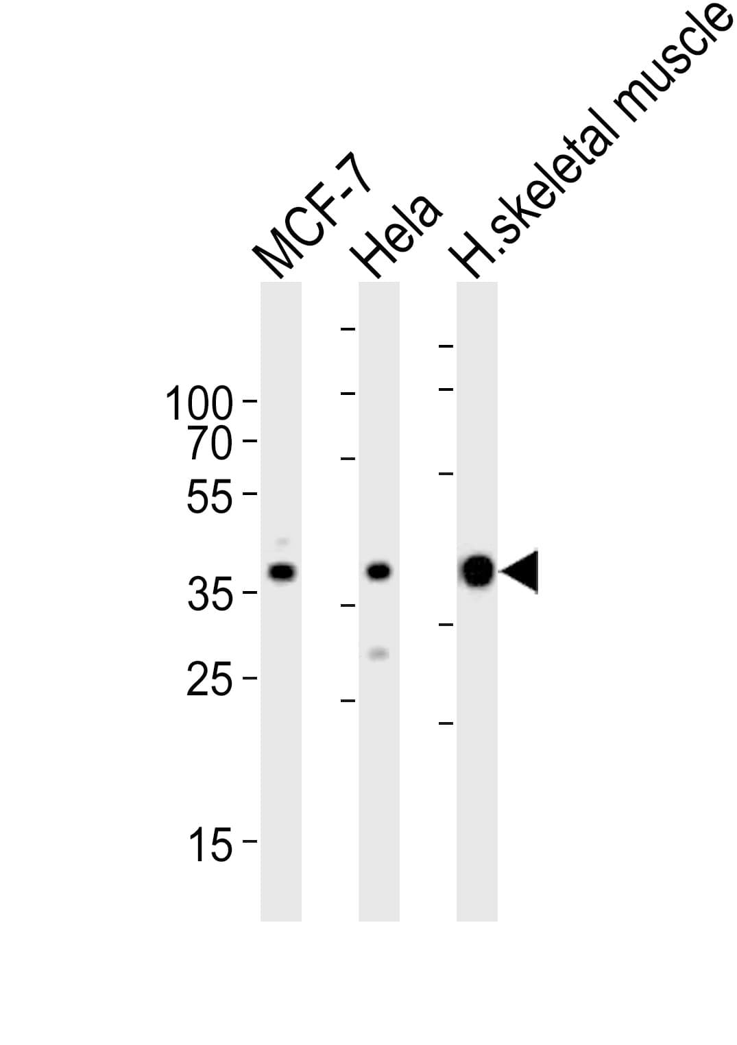 ALDOA / Aldolase A Antibody (aa303-331)