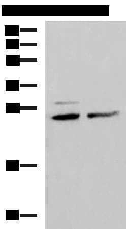 SNRPB2 Antibody