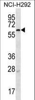MBTPS2 Antibody (aa15-44)