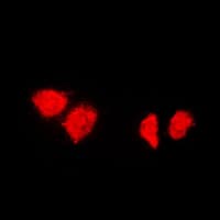 Polyclonal Rabbit anti-Human DNAJB1 / Hsp40 Antibody (C-Terminus, IHC, IF, WB)