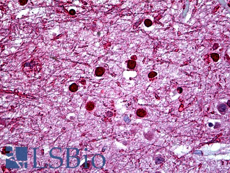 IHC-plus™ Monoclonal Mouse anti-Human HMX2 Antibody (clone 1D7, IHC, WB)