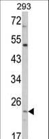 IHC-plus™ ATP5O Antibody (aa38-64)