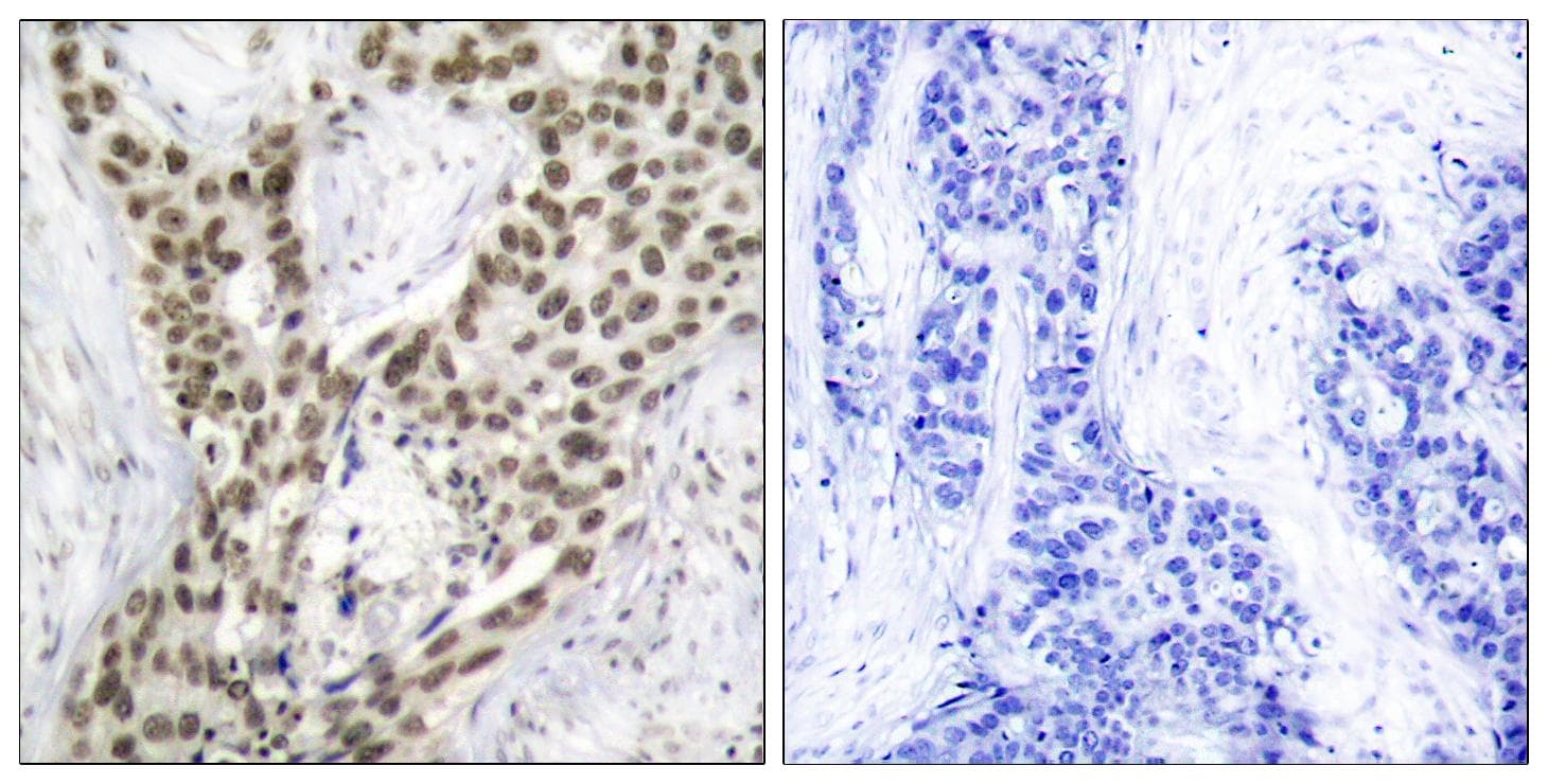 Polyclonal Rabbit anti-Human AR / Androgen Receptor Antibody (phospho-Ser213, IHC)