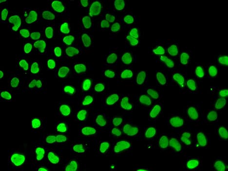 DNMT3L Antibody
