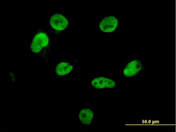 IHC-plus™ HNRPM / HNRNPM Antibody (clone 3F7)