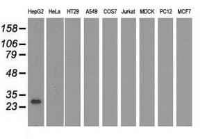 UCK1 Antibody (clone OTI4H1)