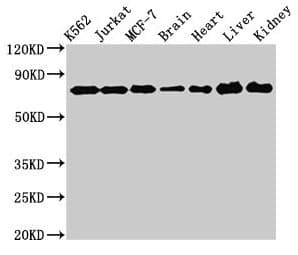 Polyclonal Rabbit anti-Human DDX3 / DDX3X Antibody (aa2-662, IHC, WB)