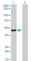 ATP6V0D1 Antibody (clone 2G12)