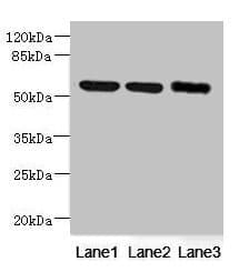 Polyclonal Rabbit anti-Human NDUFV1 Antibody (IHC, WB)