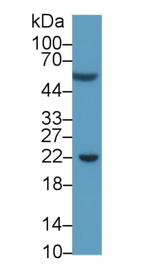 CD274 / B7-H1 / PD-L1 Antibody