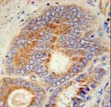 Polyclonal Rabbit anti-Human Skn / HHAT Antibody (aa30-59, IHC, WB)