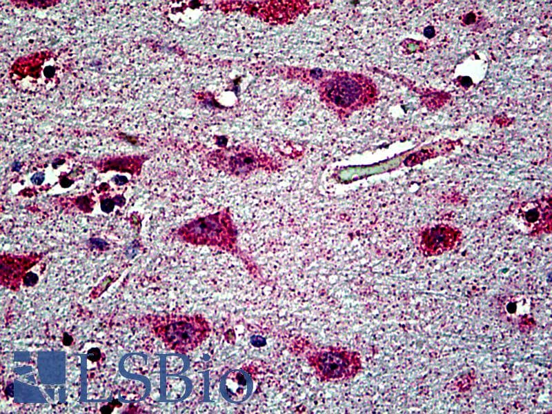 IHC-plus™ Polyclonal Goat anti-Human Testilin / EHD1 Antibody (aa2-15, IHC)