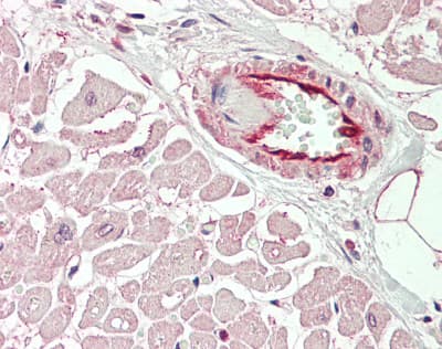 KCNIP2 / KCHIP2 Antibody (aa40-89)