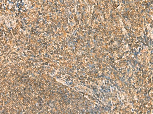 Polyclonal Rabbit anti-Human SSSCA1 / p27 Antibody (IHC)