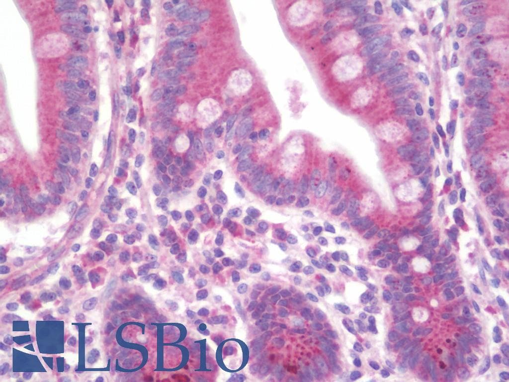 IHC-plus™ ZNF395 Antibody (aa141-170)