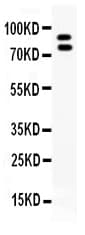 MMP9 / Gelatinase B Antibody