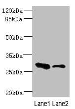 EAF2 / U19 Antibody
