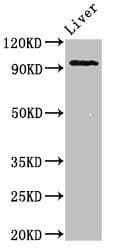 Polyclonal Rabbit anti-Human KDM1A / LSD1 Antibody (IHC, IF, WB)