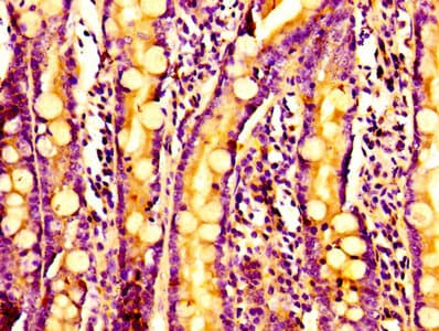 Polyclonal Rabbit anti-Human AATF Antibody (IHC, WB)