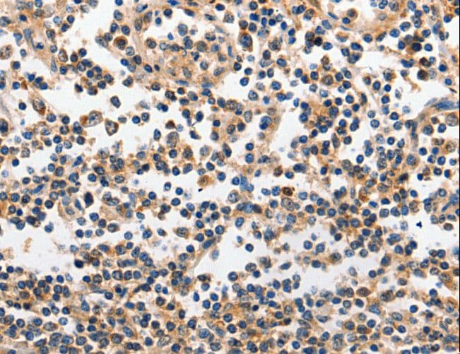 INHA / Inhibin Alpha Antibody