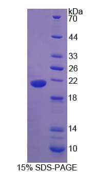 Rat ADIPOR2 Protein (Recombinant His)