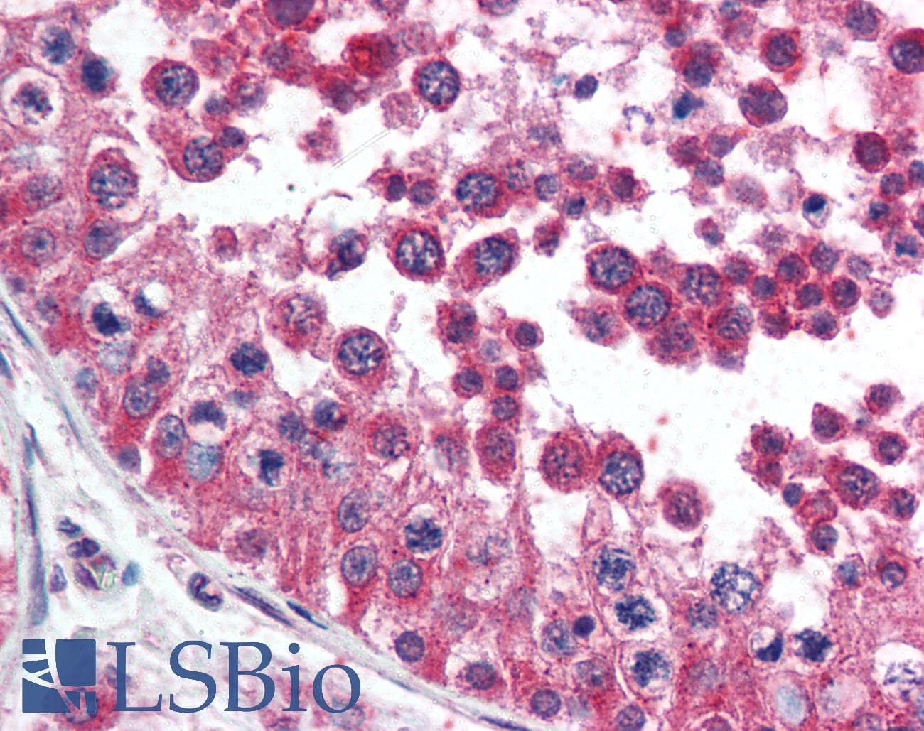 PathPlus™ HAVCR1 / KIM-1 Antibody (aa200-300)