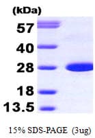 Human CALB1 / Calbindin Protein (Recombinant)