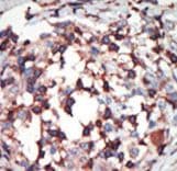 Polyclonal Rabbit anti-Human PRKCB / PKC-Beta Antibody (aa303-334, IHC, WB)
