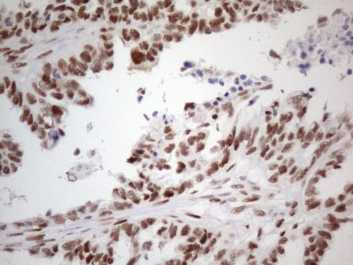 TP53BP1 / 53BP1 Antibody (aa1-300, clone OTI5E1)