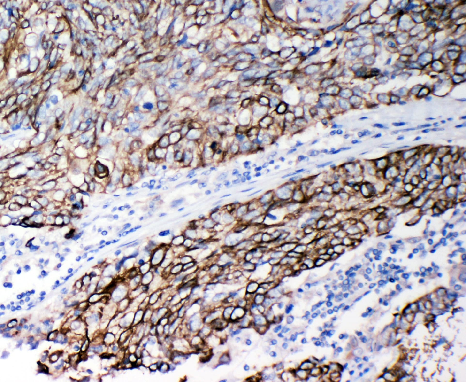 CSTB / Cystatin B / Stefin B Antibody (aa26-45)