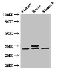 SCGN / Secretagogin Antibody