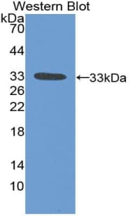 BIRC1 / NAIP Antibody (aa500-759)