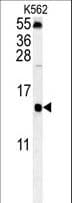 LSM4 Antibody (aa47-74)
