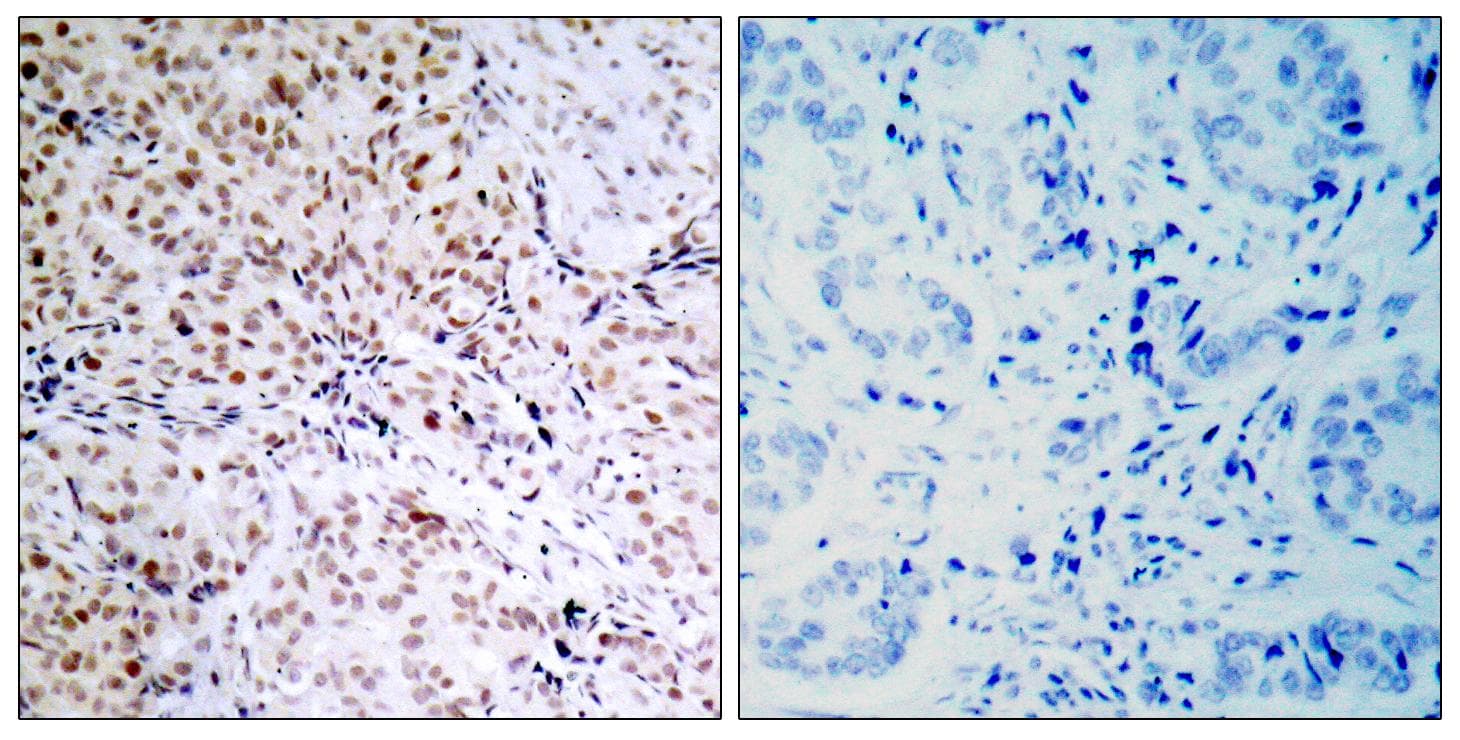 RB1 / Retinoblastoma / RB Antibody (phospho-Ser795)