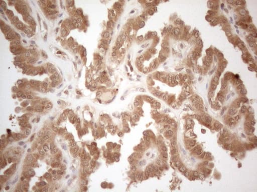 Monoclonal Mouse anti-Human PPP1CA / PP1-Alpha Antibody (clone OTI6E5, IHC, WB)