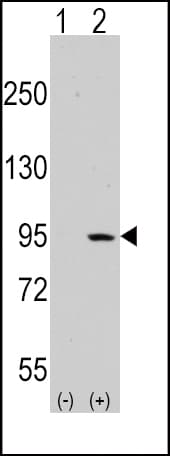 NEP / DDR1 Antibody (aa299-330)