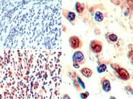 NRP1 / Neuropilin 1 Antibody (aa813-827)