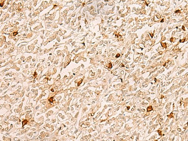 Polyclonal Rabbit anti-Human TBCK / TBCKL Antibody (IHC)