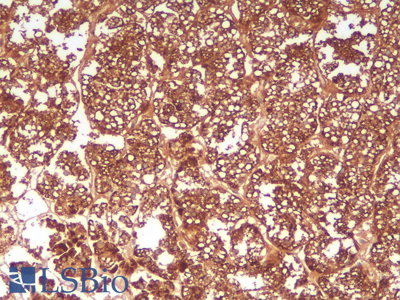 IHC-plus™ HSPD1 / HSP60 Antibody (clone rGROEL/780)