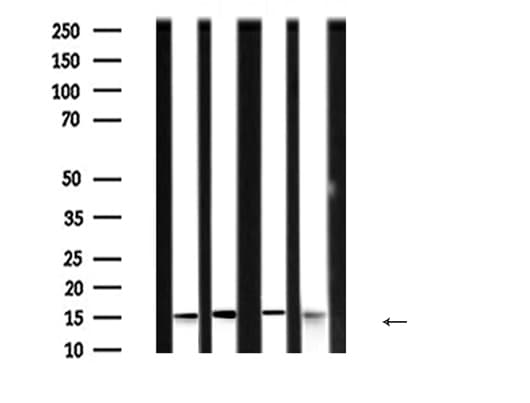 PFN1 / Profilin 1 Antibody
