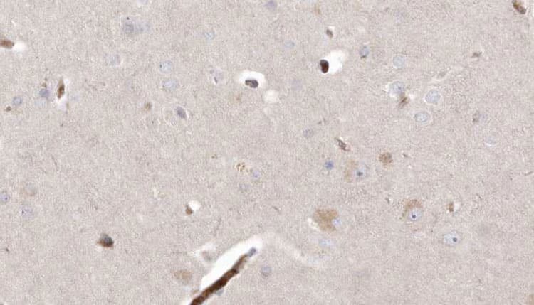 L2HGDH Antibody