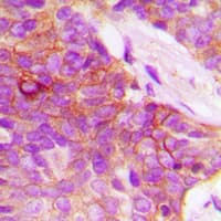 Polyclonal Rabbit anti-Human EMA / MUC1 Antibody (C-Terminus, IHC, IF, WB)