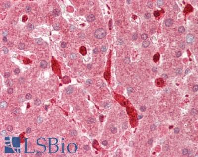 PFN1 / Profilin 1 Antibody (N-Terminus)