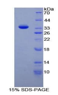 Human TAF1 Protein (Recombinant His-T7)
