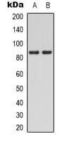 PIK3R1 / p85 Alpha Antibody (C-Terminus)